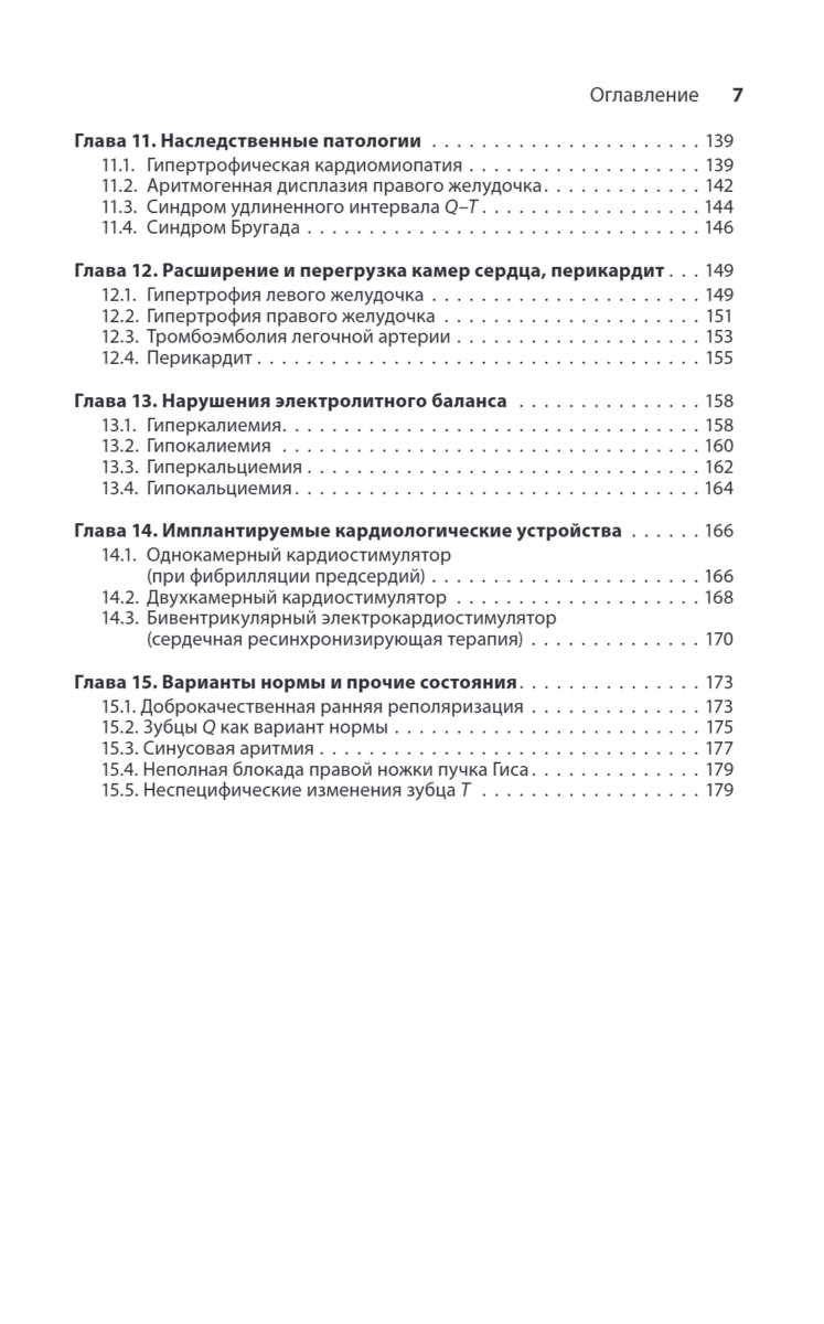 Карманный справочник по ЭКГ — изображение 4