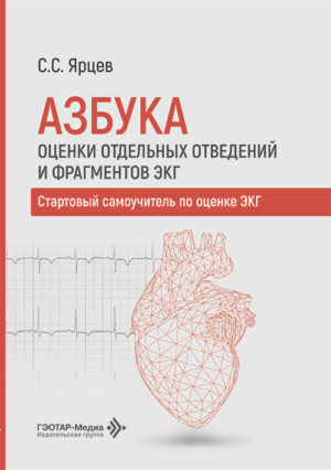Азбука оценки отдельных отведений и фрагментов ЭКГ. Стартовый самоучитель по оценке ЭКГ
