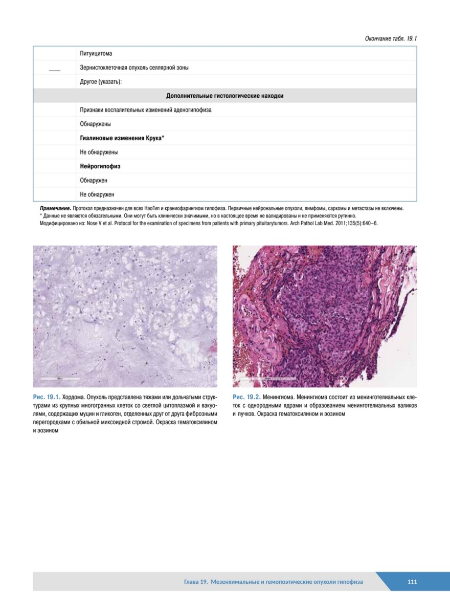 Патологическая анатомия органов эндокринной системы. Гипофиз — изображение 7