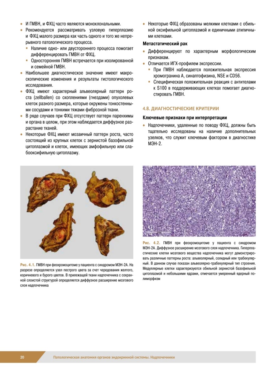 Патологическая анатомия органов эндокринной системы. Надпочечники — изображение 8