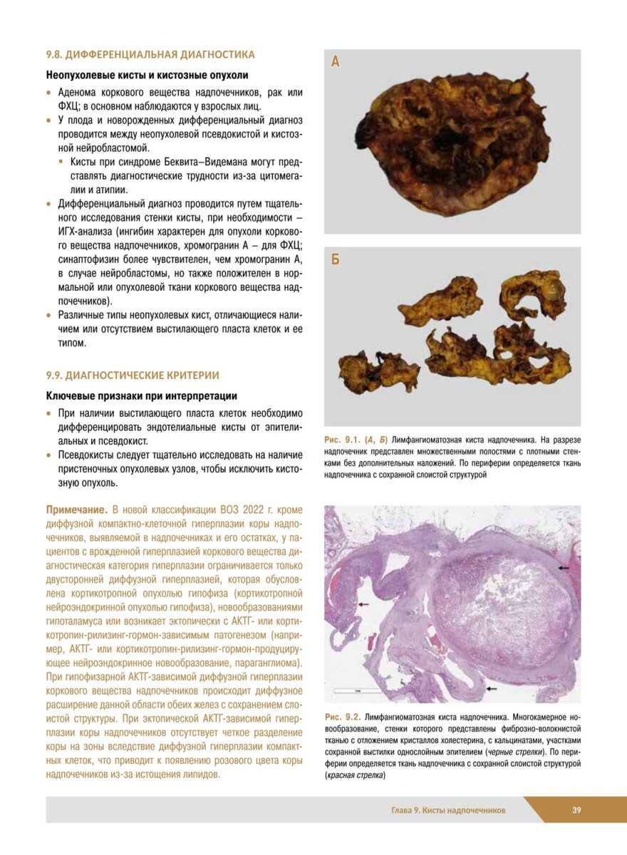 Патологическая анатомия органов эндокринной системы. Надпочечники — изображение 6