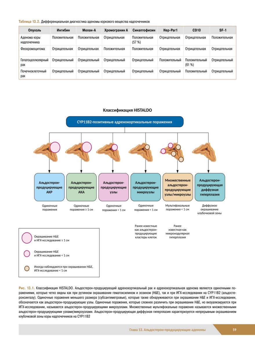 Патологическая анатомия органов эндокринной системы. Надпочечники — изображение 4