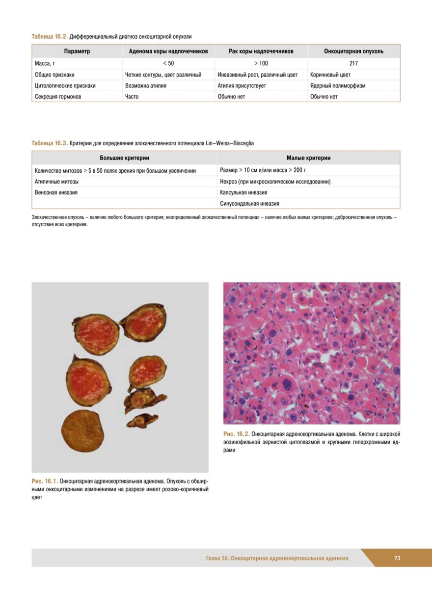 Патологическая анатомия органов эндокринной системы. Надпочечники — изображение 3