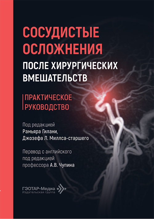 Сосудистые осложнения после хирургических вмешательств. Практическое руководство