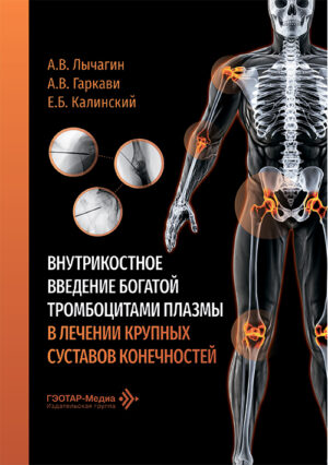 Внутрикостное введение богатой тромбоцитами плазмы в лечении крупных суставов конечностей
