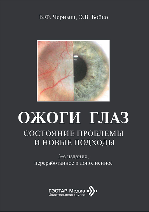 Ожоги глаз. Состояние проблемы и новые подходы