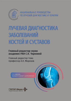 Лучевая диагностика заболеваний костей и суставов. Национальное руководство