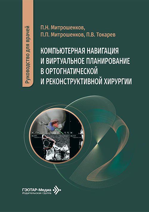 Компьютерная навигация и виртуальное планирование в ортогнатической и реконструктивной хирургии. Руководство для врачей