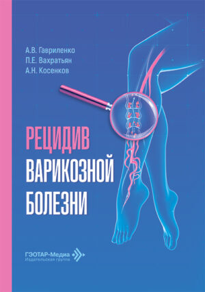 Рецидив варикозной болезни