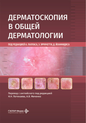 Дерматоскопия в общей дерматологии