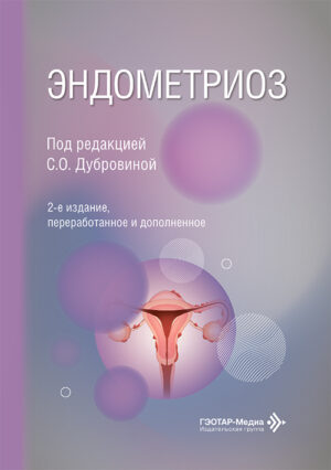 Эндометриоз