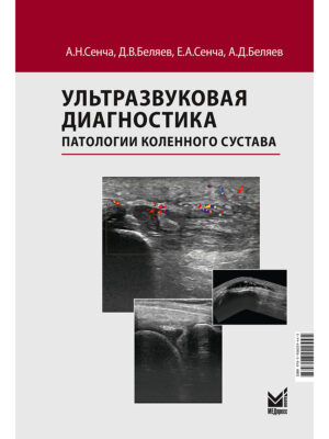Ультразвуковая диагностика патологии коленного сустава