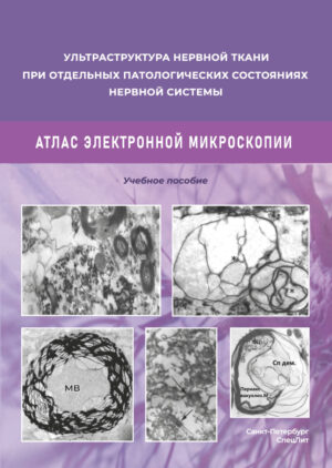 Ульстраструктура нервной ткани при отдельных патологических состояниях нервной системы. Атлас  электронной микроскопии