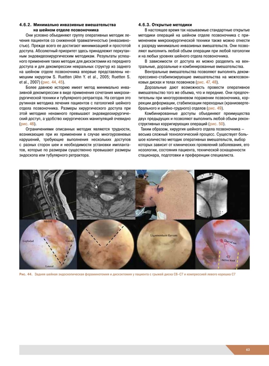 Хирургические заболевания и повреждения шеи. Основы цервикологии. Руководство для врачей — изображение 7