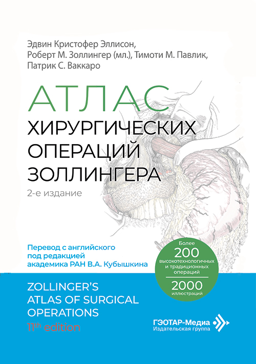 Атлас хирургических операций Золлингера