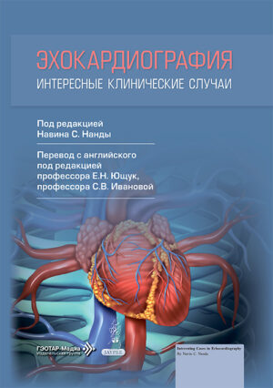Эхокардиография. Интересные клинические случаи