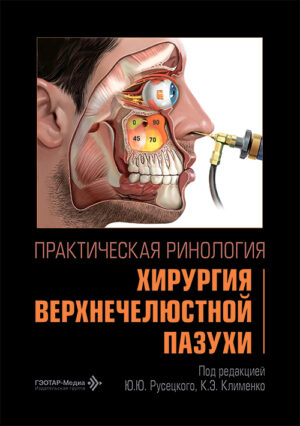 Практическая ринология. Хирургия верхнечелюстной пазухи