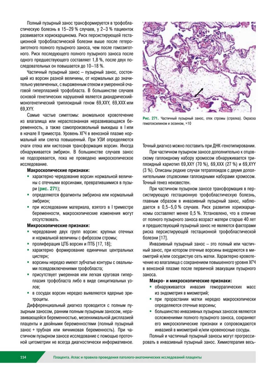 Плацента. Атлас и правила проведения патолого-анатомических исследований — изображение 4