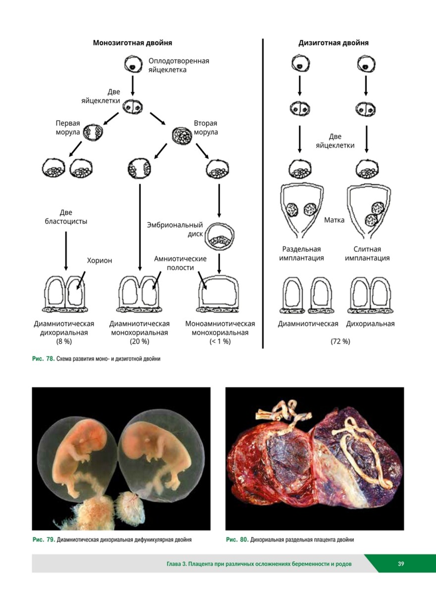 Плацента. Атлас и правила проведения патолого-анатомических исследований — изображение 6