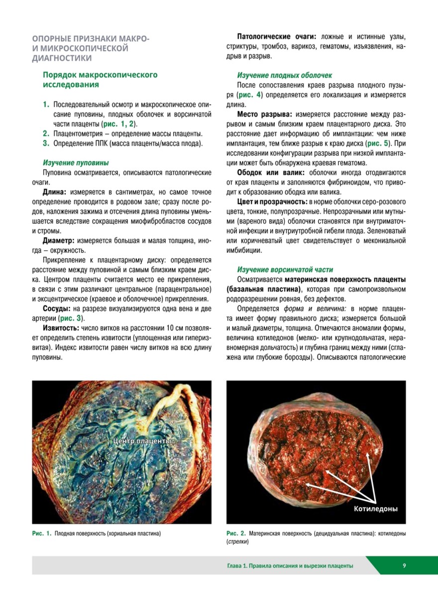 Плацента. Атлас и правила проведения патолого-анатомических исследований — изображение 8