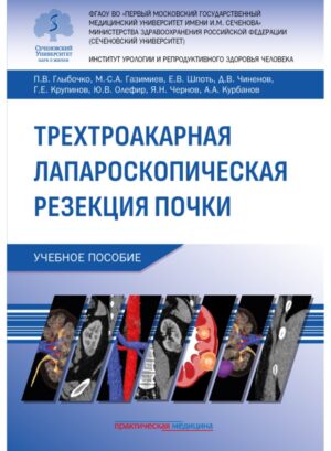 Трехтроакарная лапароскопическая резекция почки