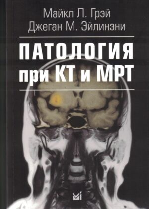 Патология при КТ и МРТ