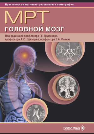 МРТ. Головной мозг. Руководство для врачей