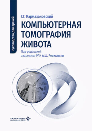 Компьютерная томография живота. Руководство для врачей