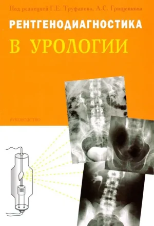 Ренгенодиагностика в урологии
