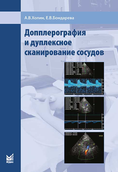 Допплерография и дуплексное сканирование сосудов