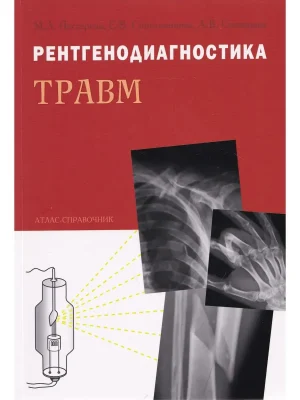 Рентгенодиагностика травм. Атлас - справочник