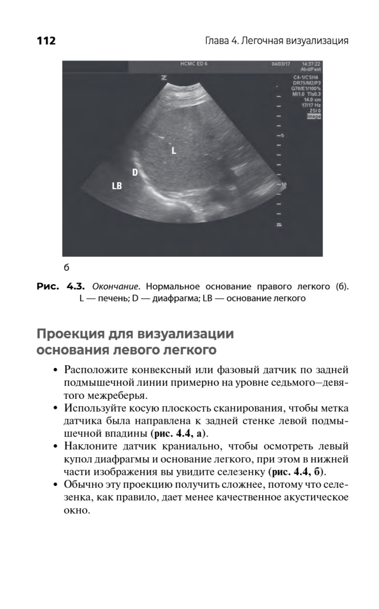 Ультразвуковое исследование при экстренных и неотложных состояниях. Карманный атлас-справочник — изображение 5