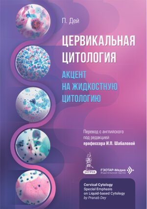 Цервикальная цитология. Акцент на жидкостную цитологию