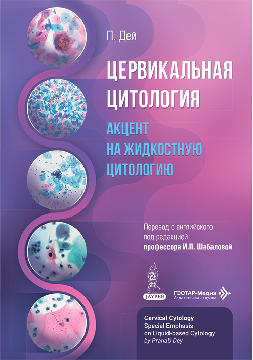 Цервикальная цитология. Акцент на жидкостную цитологию