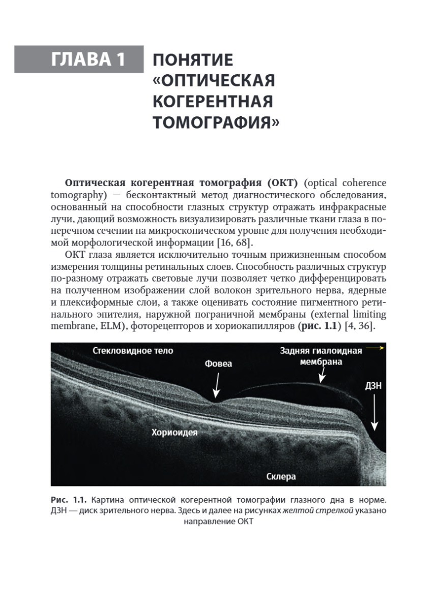 Черно-белые детали оптической когерентной томографии глаза — изображение 5