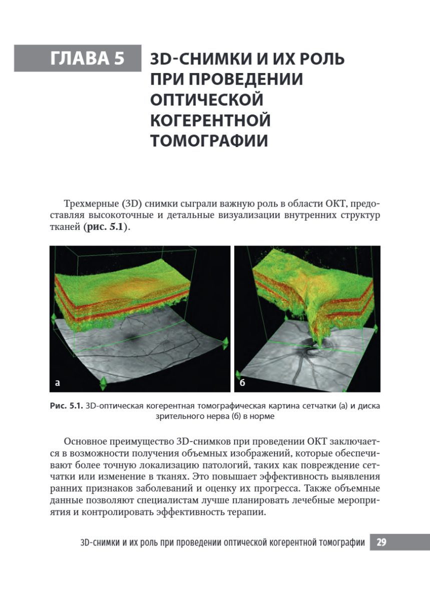 Черно-белые детали оптической когерентной томографии глаза — изображение 3