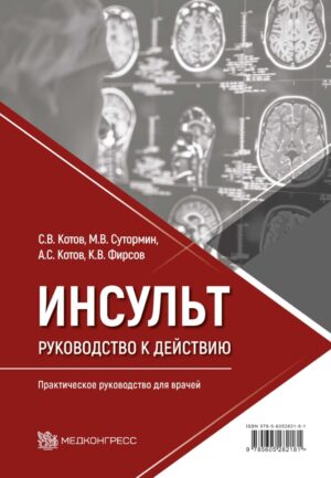 Инсульт: руководство к действию. Практическое руководство для врачей
