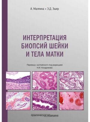 Интерпретация биопсий шейки и тела матки