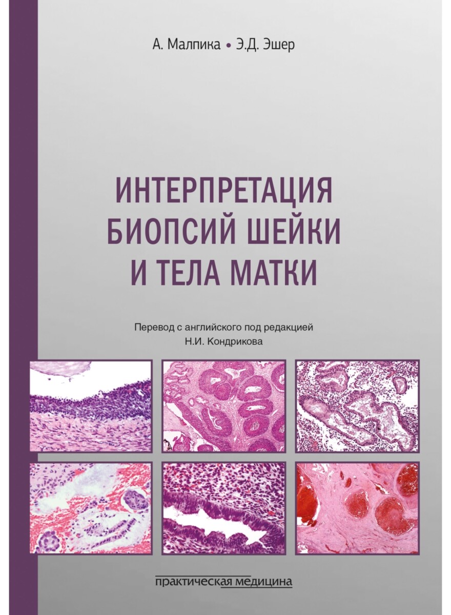 Интерпретация биопсий шейки и тела матки