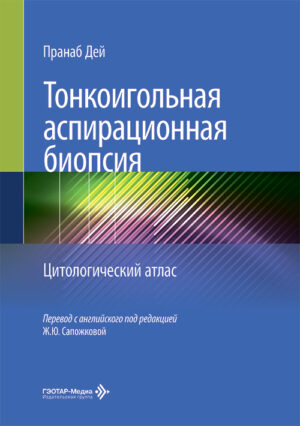 Тонкоигольная аспирационная биопсия. Цитологический атлас