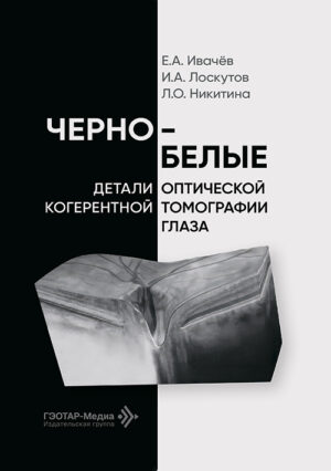 Черно-белые детали оптической когерентной томографии глаза