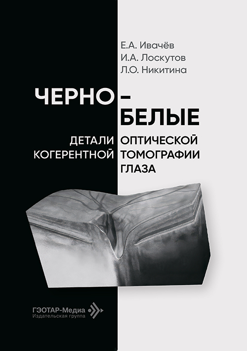 Черно-белые детали оптической когерентной томографии глаза