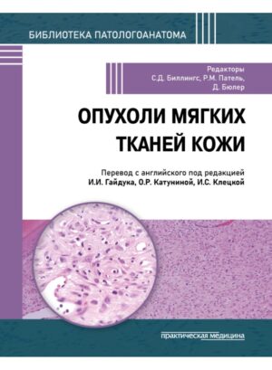 Опухоли мягких тканей кожи