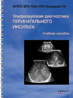 Ультразвуковая диагностика перинатального инсульта