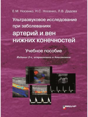 Ультразвуковое исследование при заболеваниях артерий и вен нижних конечностей. 2-е издание
