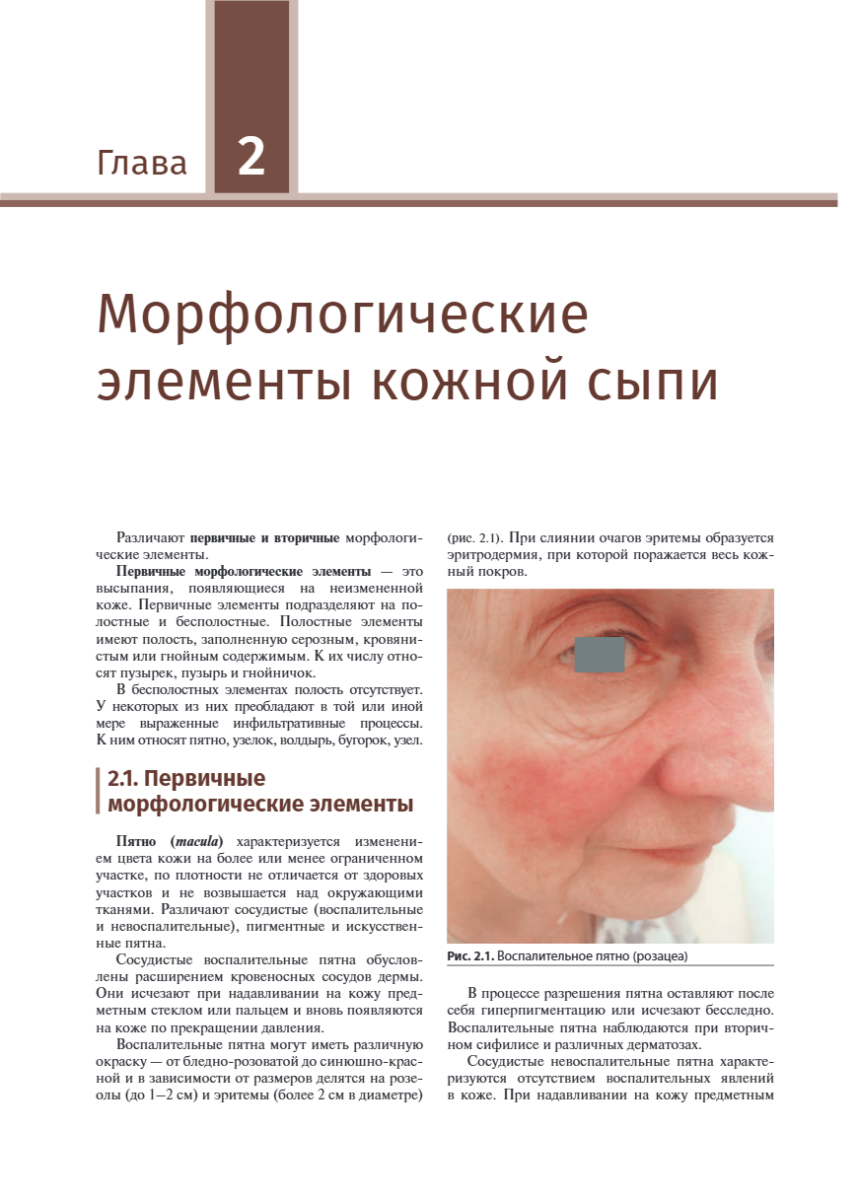 Иллюстрированное руководство по дерматологии (при подготовке врачей к аккредитации) — изображение 7