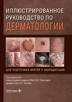 Иллюстрированное руководство по дерматологии (при подготовке врачей к аккредитации)