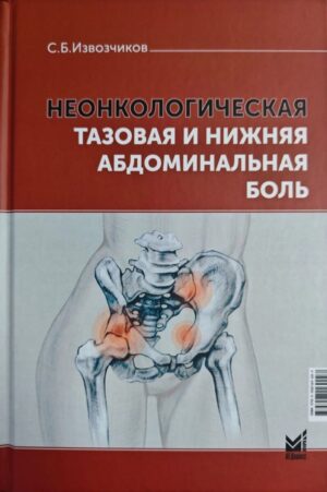 Неонкологическая тазовая и нижняя абдоминальная боль