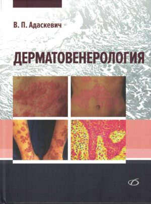 Дерматовенерология