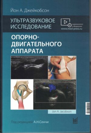 Ультразвуковое исследование опорно-двигательного аппарата